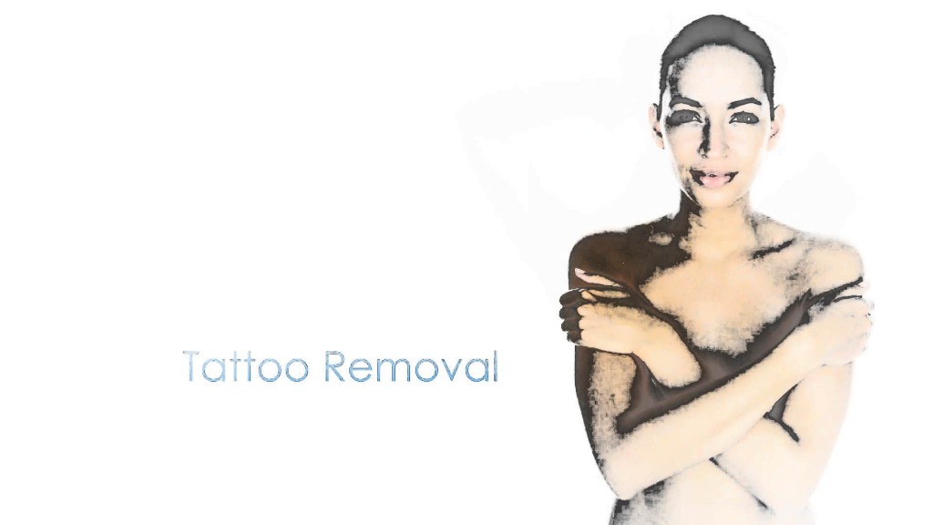 laser-tattoo-removal